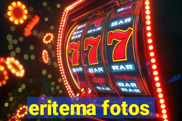 eritema fotos